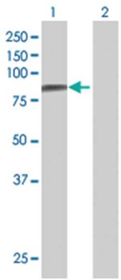 PARN 293T Cell Overexpression Lysate (Denatured), Abnova 100 &mu;L | Buy Online | Abnova | Fisher Scientific
