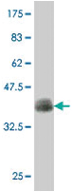 PBX2, Mouse, Polyclonal Antibody, Abnova 50 &mu;L | Buy Online | Abnova | Fisher Scientific