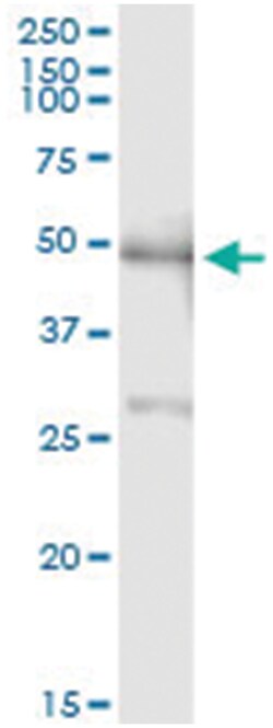 anti-PBX2, Human, IP-WB Antibody Pair, Abnova&trade;