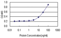 anti-PCK1 Matched Antibody Pair, Abnova&trade;