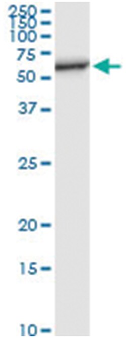 PCTK1, Human, IP-WB Antibody Pair (PW1), Abnova 1 Set:Antibodies, Monoclonal/Polyclonal
