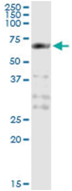 PCTK1, Human, IP-WB Antibody Pair (PW2), Abnova™