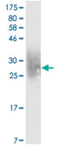 anti-PDCD1, Clone: 6B10, Abnova 100&mu;g, Unlabeled:Antibodies, Monoclonal