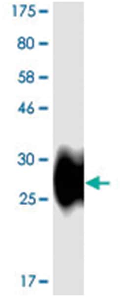 anti-PDCD1, Clone: 5F5, Abnova 100 &mu;g | Buy Online | Abnova Corporation | Fisher Scientific