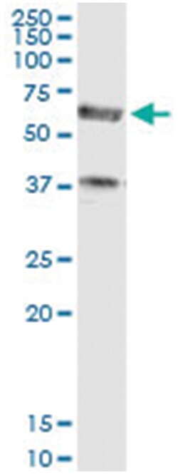 anti-PDE1A, Human, IP-WB Antibody Pair, Abnova&trade;
