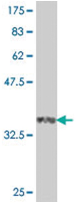 PDE7A, Mouse, Polyclonal Antibody, Abnova 50&mu;L; Unlabeled:Antibodies,