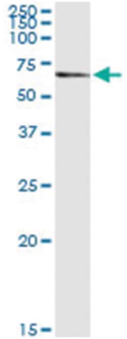 anti-PDE9A, Human, IP-WB Antibody Pair, Abnova 1 Set:Antibodies, Monoclonal/Polyclonal