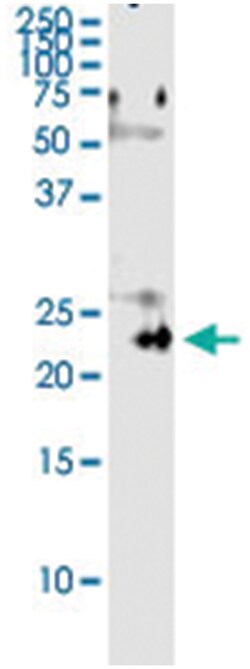 anti-PDGFA, Human, IP-WB Antibody Pair, Abnova&trade;