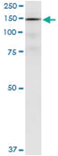 anti-PDGFRA, Human, IP-WB Antibody Pair, Abnova&trade;
