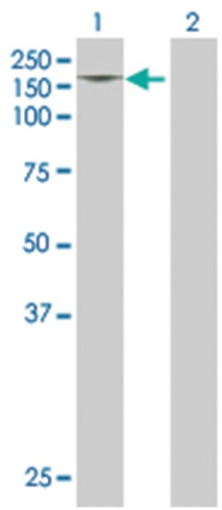 PDGFRA 293T Cell Overexpression Lysate (Denatured), Abnova 100 &mu;l | Buy Online | Abnova | Fisher Scientific