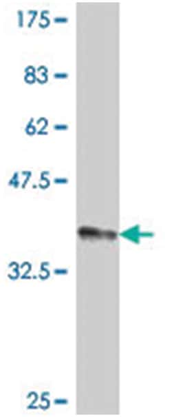 PDGFRL, Mouse, Polyclonal Antibody, Abnova 50&mu;L; Unlabeled:Antibodies,