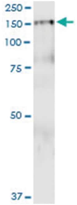 PDGFRB, Human, IP-WB Antibody Pair (PW2), Abnova™