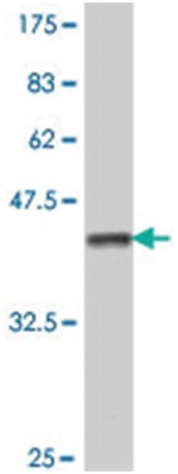 PDK4 (A01), Mouse anti-Human, Polyclonal Antibody, Abnova 50&mu;L; Unlabeled:Antibodies,