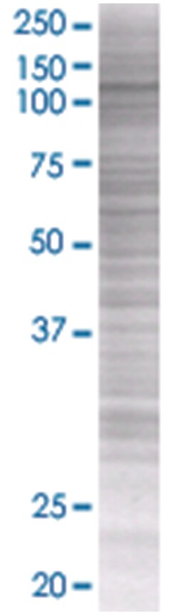 ENPP1 293T Cell Overexpression Lysate (Denatured), Abnova 100 &mu;L | Buy Online | Abnova | Fisher Scientific