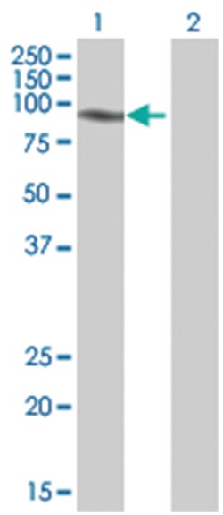 ENPP1 293T Cell Overexpression Lysate (Denatured), Abnova 100 &mu;L | Buy Online | Abnova | Fisher Scientific