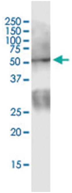 anti-PDPK1, Human, IP-WB Antibody Pair, Abnova&trade;