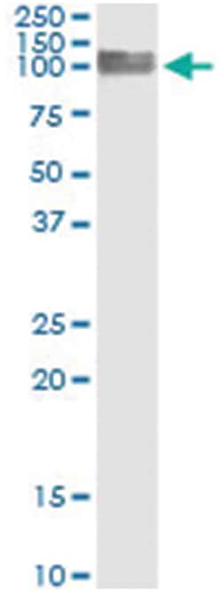 anti-PECAM1, Human, IP-WB Antibody Pair, Abnova™