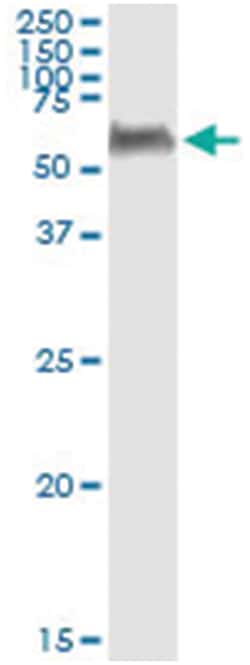 PEPD, Human, IP-WB Antibody Pair (PW2), Abnova™