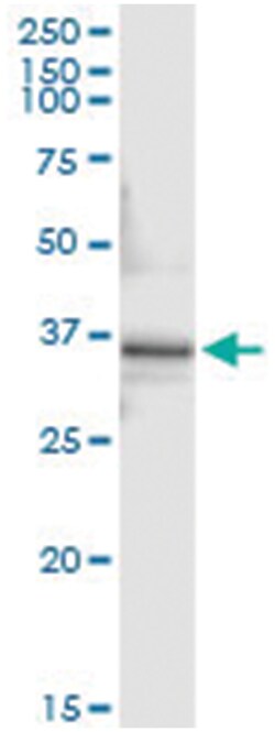 anti-PEX10, Human, IP-WB Antibody Pair, Abnova&trade;