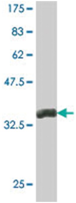 PFKFB1, Mouse, Polyclonal Antibody, Abnova 50&mu;L; Unlabeled:Antibodies,