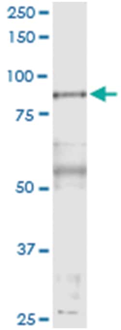 anti-PFKP, Human, IP-WB Antibody Pair, Abnova 1 Set:Antibodies, Monoclonal/Polyclonal