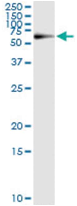 anti-PGM1, Human, IP-WB Antibody Pair, Abnova™