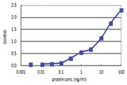 anti-PHKG2, Human, Matched Antibody Pair, Abnova™