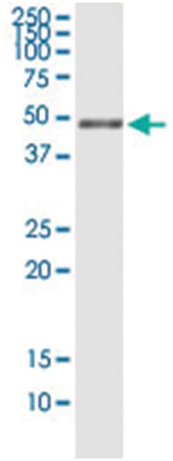 anti-PHKG2, Human, IP-WB Antibody Pair, Abnova&trade;
