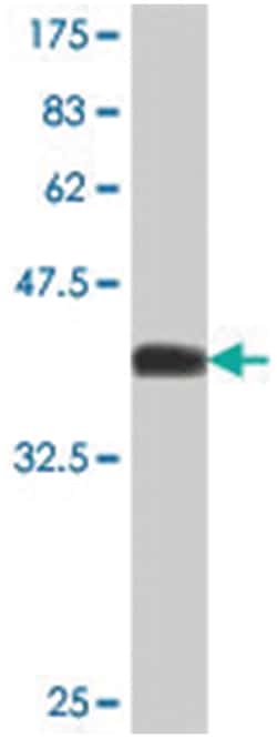 PIK3C2B, Mouse, Polyclonal Antibody, Abnova 50&mu;L; Unlabeled:Antibodies,