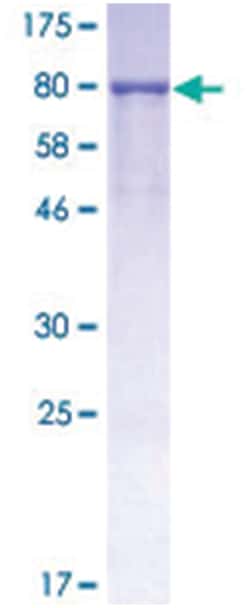 Abnova PIP Recombinant Protein 10 &mu;g | Buy Online | Abnova&trade; | Fisher Scientific