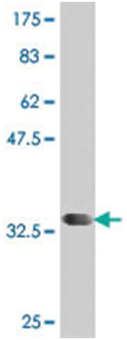 PIP5K2A, Mouse, Polyclonal Antibody, Abnova 50 &mu;L | Buy Online | Abnova | Fisher Scientific