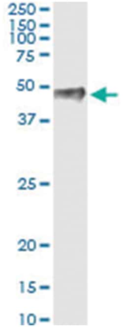 anti-PITX1, Human, IP-WB Antibody Pair, Abnova 1 Set:Antibodies, Monoclonal/Polyclonal