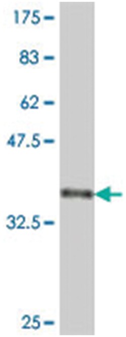 PITX2 (A03), Mouse anti-Human, Polyclonal Antibody, Abnova 50&mu;L; Unlabeled:Antibodies,