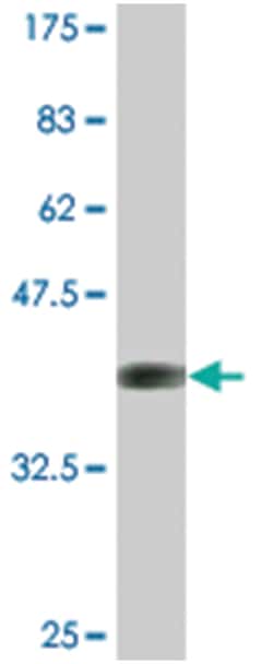 pleiomorphic adenoma gene-like 1, Mouse, Clone: 1E2, Abnova 200&mu;L; Unlabeled:Antibodies,