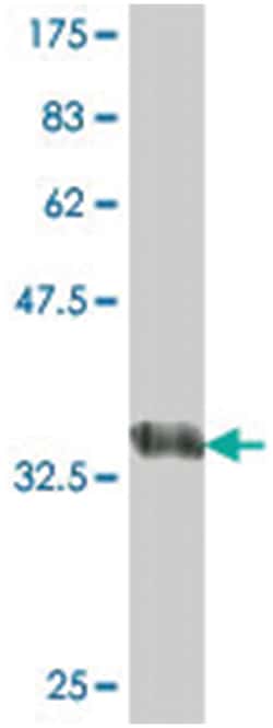 PLAUR (A02), Mouse anti-Human, Polyclonal Antibody, Abnova 50 &mu;L | Buy Online | Abnova Corporation | Fisher Scientific
