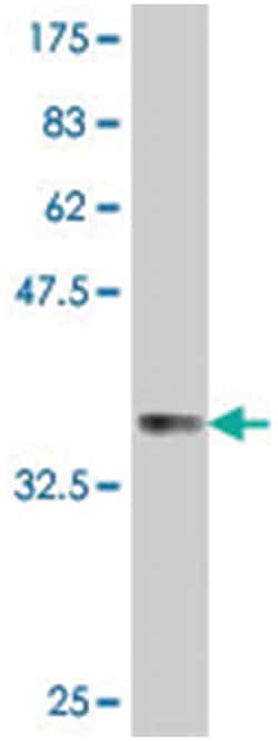 PLD2, Mouse, Polyclonal Antibody, Abnova 50&mu;L; Unlabeled:Antibodies,