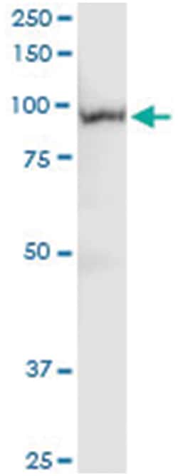 anti-PLG, Human, IP-WB Antibody Pair, Abnova 1 Set:Antibodies, Monoclonal/Polyclonal