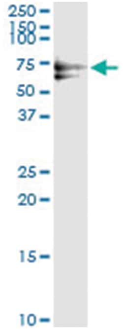 PLK1, Human, IP-WB Antibody Pair (PW1), Abnova&trade;