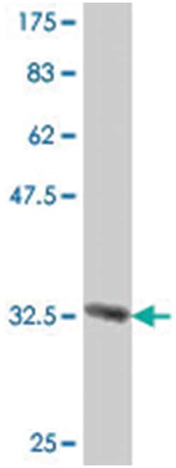FXYD domain containing ion transport regulator 3, Mouse, Polyclonal Antibody, Abnova 50 &mu;L | Buy Online | Abnova Corporation | Fisher Scientific