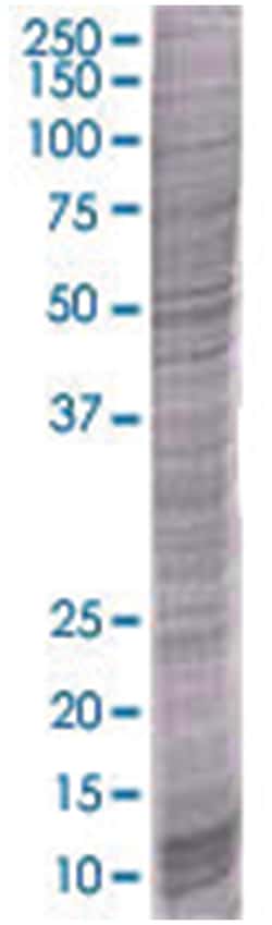 FXYD3 293T Cell Overexpression Lysate (Denatured), Abnova 100&mu;L | Buy Online | Abnova | Fisher Scientific