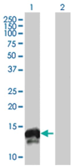 FXYD3 293T Cell Overexpression Lysate (Denatured), Abnova 100&mu;L | Buy Online | Abnova | Fisher Scientific