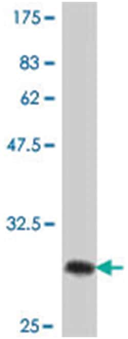 PLN, Mouse, Polyclonal Antibody, Abnova 50&mu;L; Unlabeled:Antibodies,