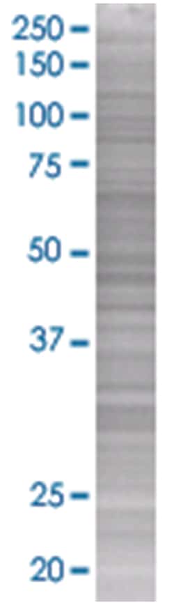 PLTP 293T Cell Overexpression Lysate (Denatured), Abnova 100&mu;L | Buy Online | Abnova | Fisher Scientific