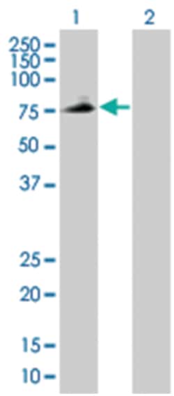 PLTP 293T Cell Overexpression Lysate (Denatured), Abnova 100&mu;L | Buy Online | Abnova | Fisher Scientific