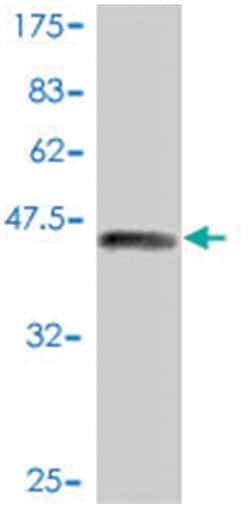 PML, Mouse, Polyclonal Antibody, Abnova 50&mu;L; Unlabeled:Antibodies,