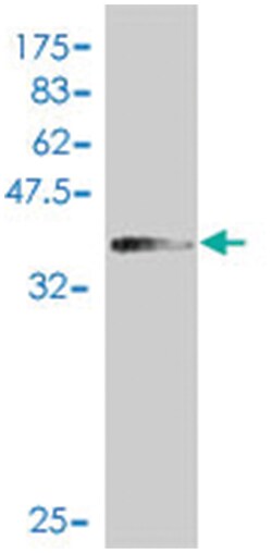 PMS1, Mouse, Polyclonal Antibody, Abnova 50&mu;L; Unlabeled:Antibodies,