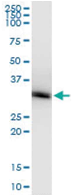 PNMT, Human, IP-WB Antibody Pair (PW1), Abnova 1 Set:Antibodies, Monoclonal/Polyclonal