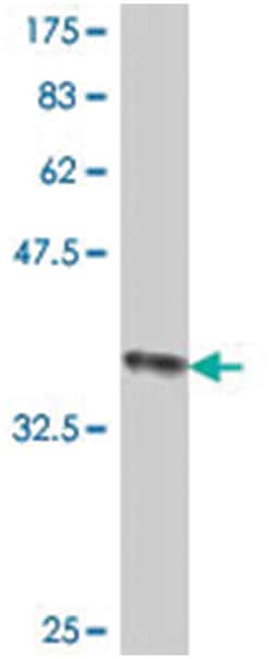 POLE2, Mouse, Polyclonal Antibody, Abnova 50&mu;L; Unlabeled:Antibodies,