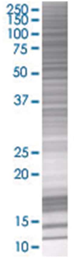 POLH 293T Cell Overexpression Lysate (Denatured), Abnova 100&mu;L | Buy Online | Abnova | Fisher Scientific