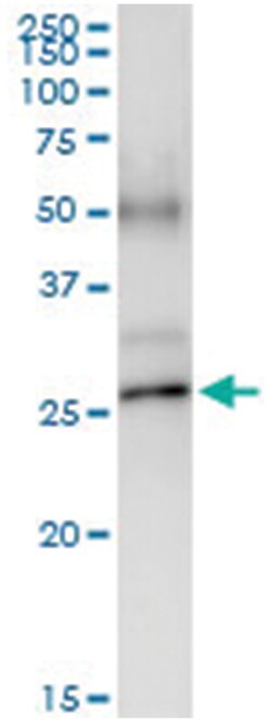 anti-POLR2E, Human, IP-WB Antibody Pair, Abnova&trade;